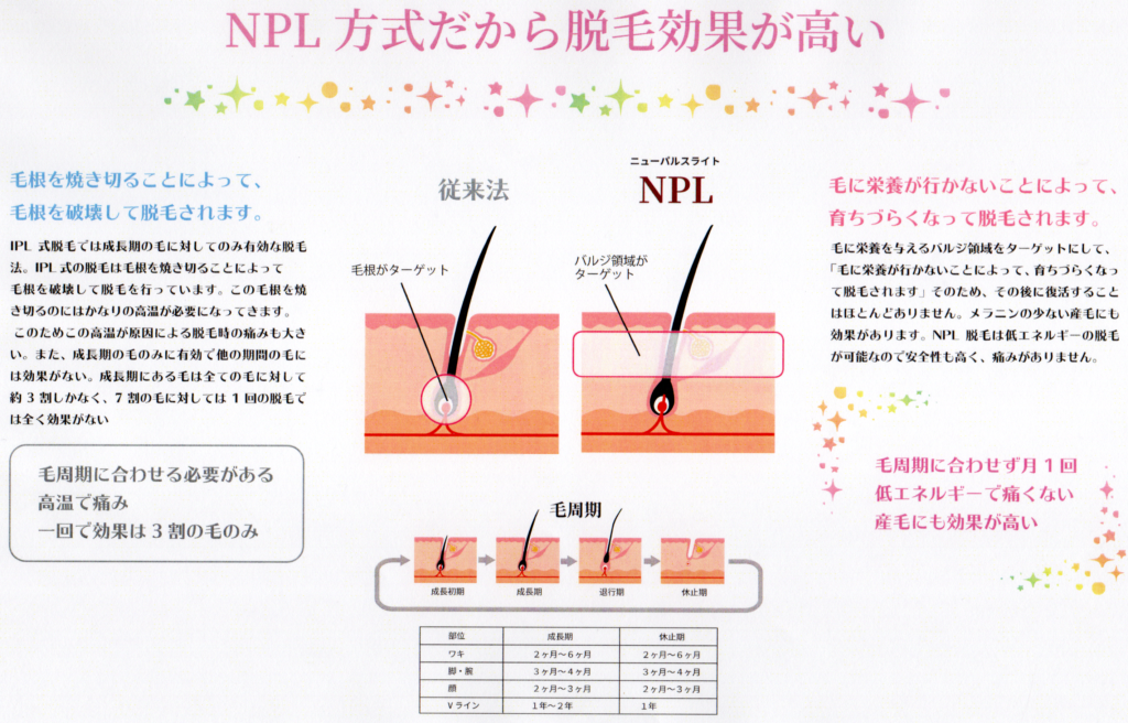 NPL方式だから脱毛効果が高い　one-shot(ワンショット) 徳島市の脱毛＆光エステサロン